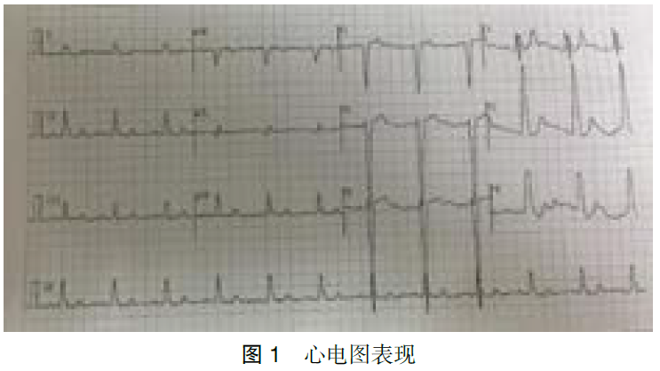 盐卤中毒误诊误治一例（高镁血症）