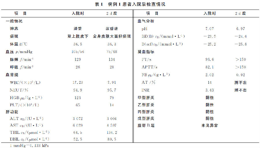 松香水中毒致死２例报告