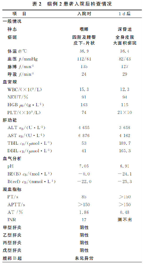 松香水中毒致死２例报告