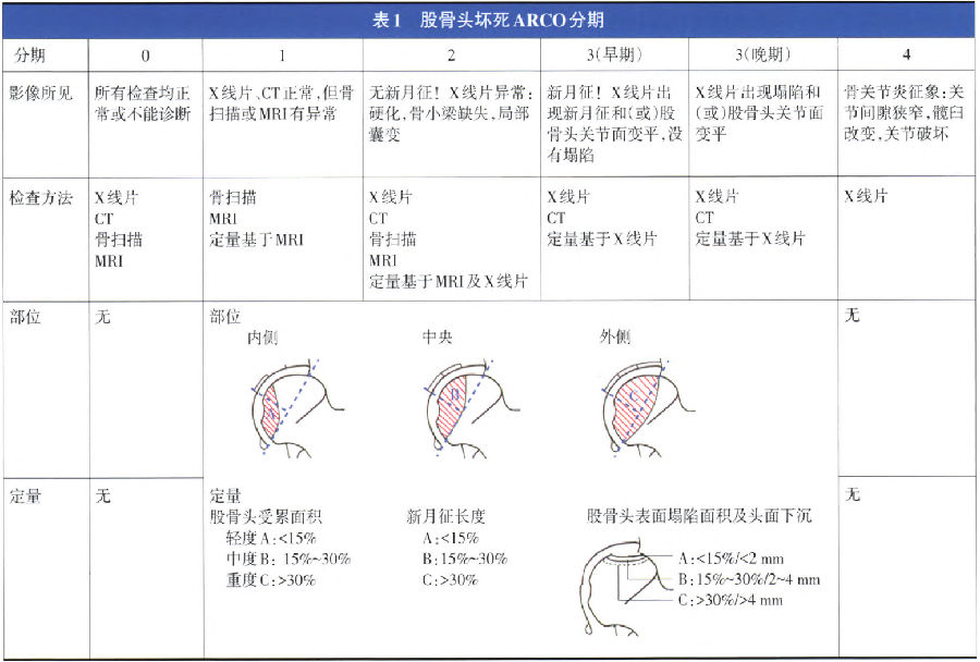 成人股骨头坏死临床诊疗指南(2016)