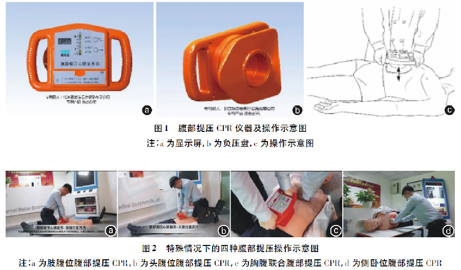 创伤性休克急救复苏新技术临床应用中国专家共识(2019)