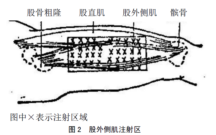 严重过敏反应诊断和早期治疗规范