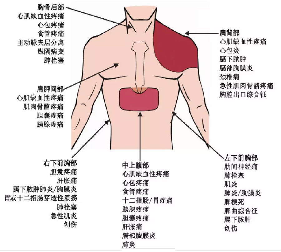 胸痛基层诊疗指南（2019年）