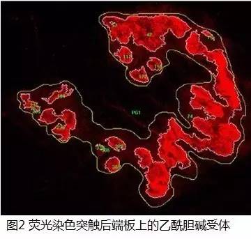 有机磷中毒后肌无力，怎么发生的？