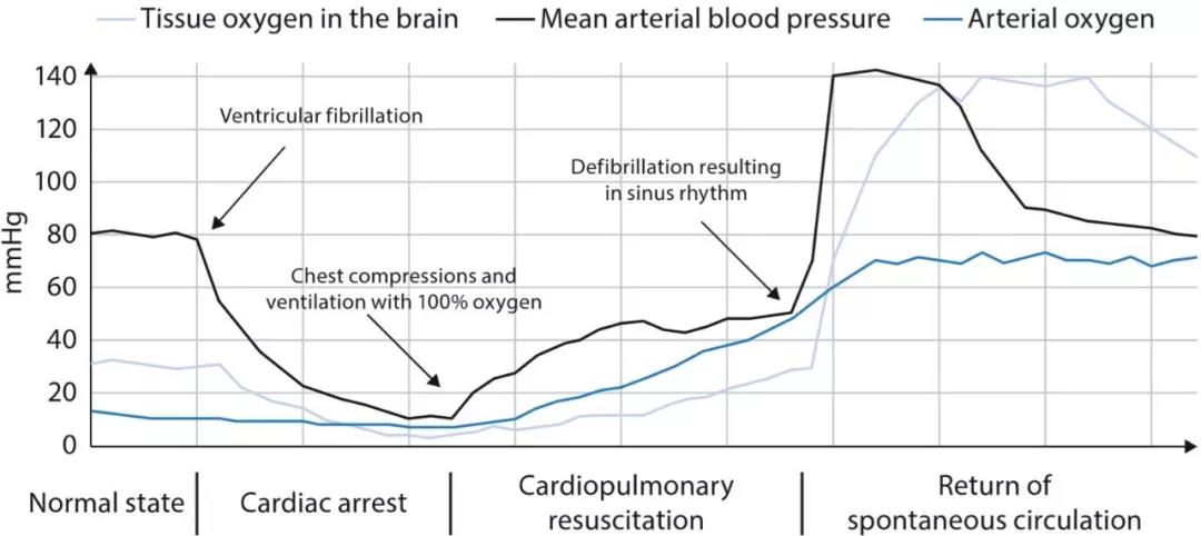 心脏骤停患者氧及二氧化碳理想目标