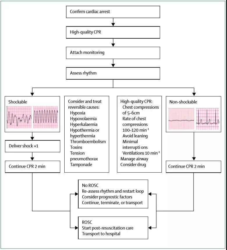 院外心脏骤停的院前管理